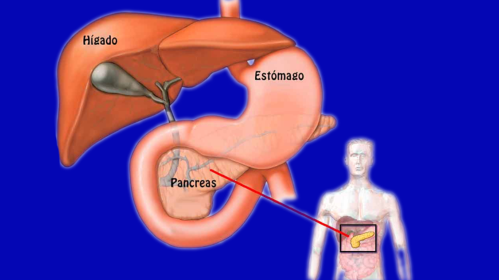 pancreatite 